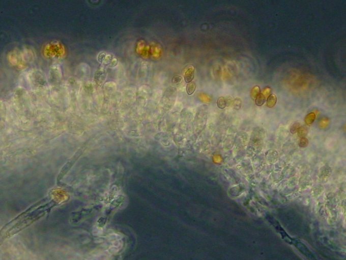 Hymenium mit braunen Basidosporen