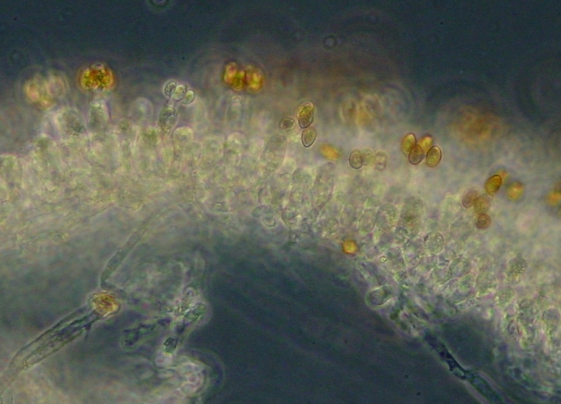 Hymenium mit braunen Basidosporen