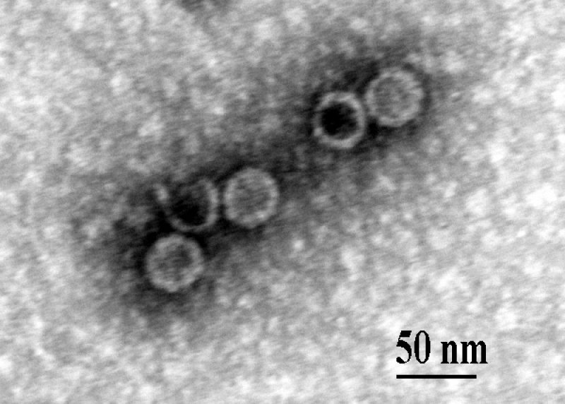 Isolierte Viruspartikel aus Helvella crispa