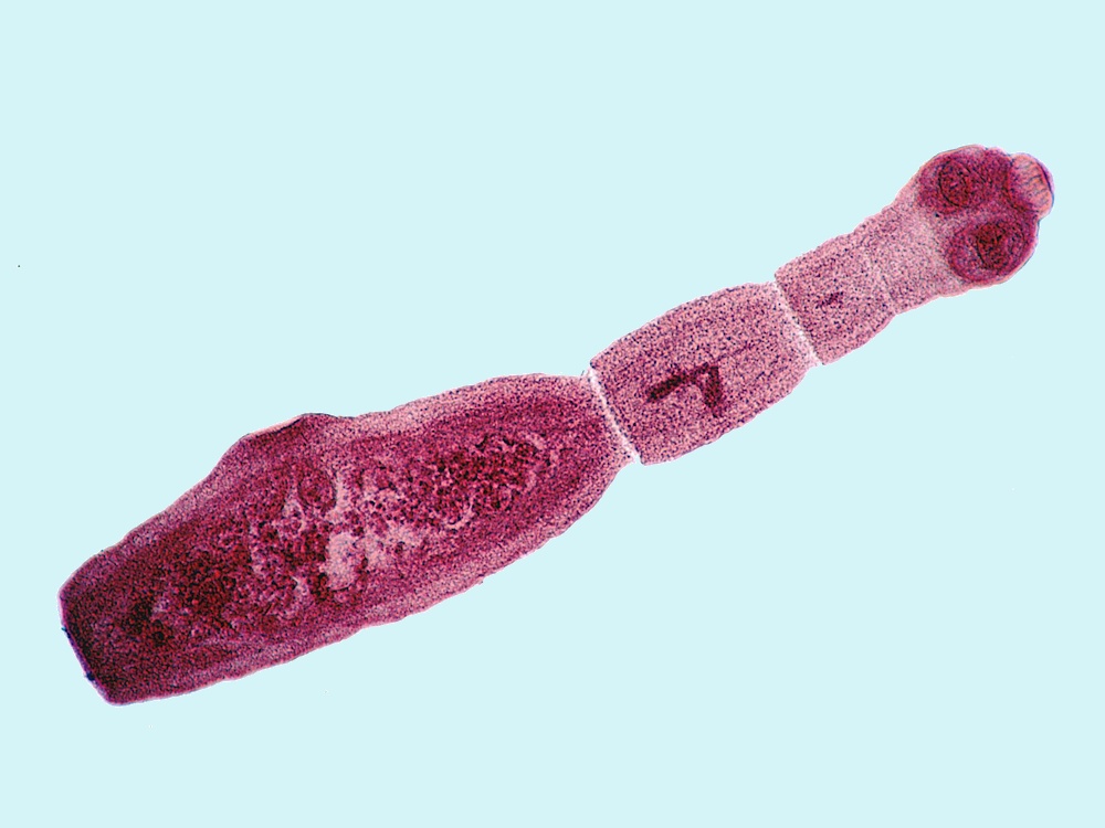 Gefahr durch Fuchsbandwurm? / DGfM